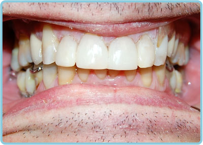 After-Dental-2