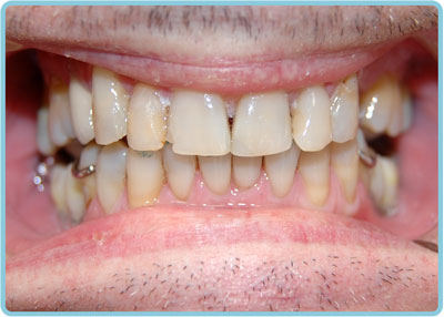 Before-Dental-2